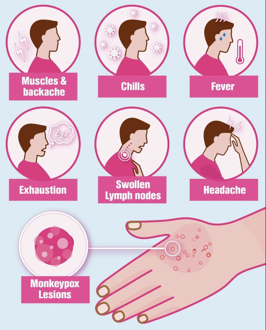 What is Monkeypox ? It's Symptoms, Causes, and Prevention Tips of mpox ?