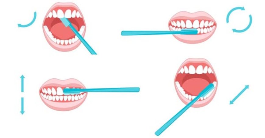 Try Brushing to recover teeth pain at home.