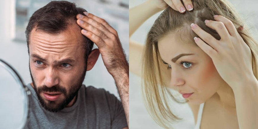 Hair Fall - 11 Reasons Even Your Doctor May Not Tell You